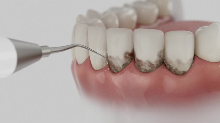Reliable Dental contractor in Bangs, TX by Smile Center Dentistry